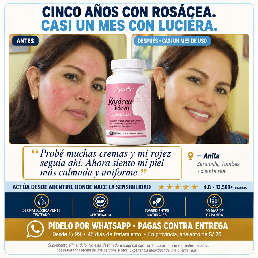 Cinco años con rosácea, casi un mes con LUCIÉRA: antes y después de Anita (Zarumilla, Tumbes), clienta real de Rosácea Relevo