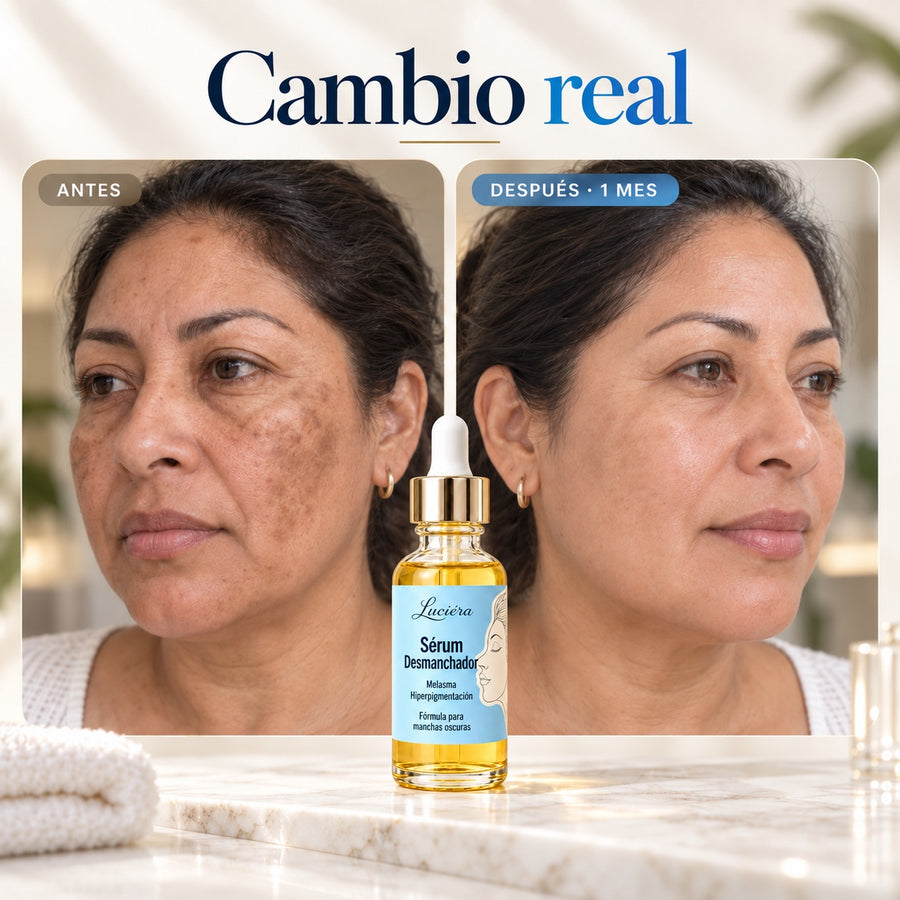 Luciéra Serum Anti-Manchas | Serum Tópico para Manchas en la Piel