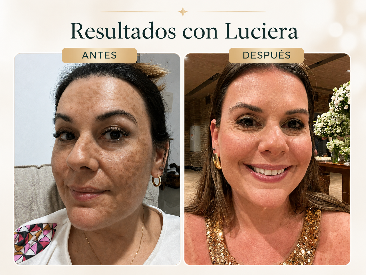 Carolina T. antes y después