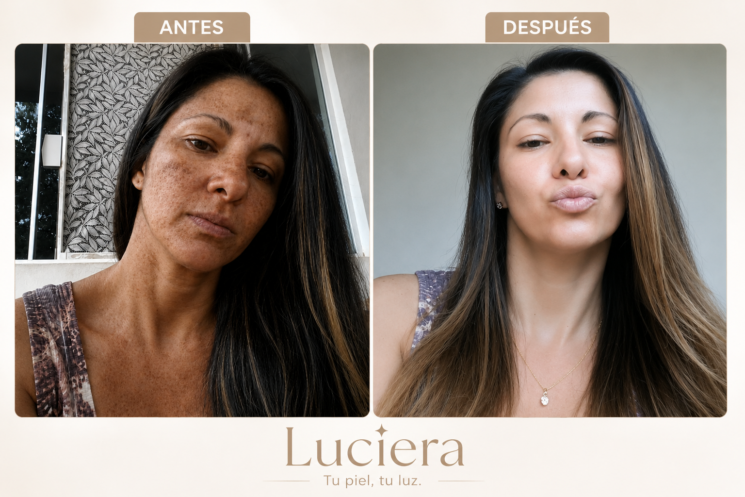 Lucía F. antes y después