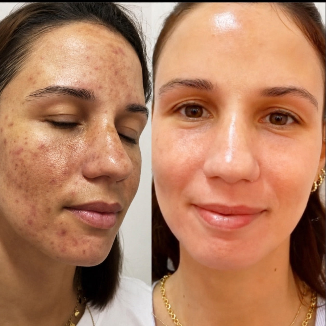 Experiencia de Daniela, 29 años – Piura