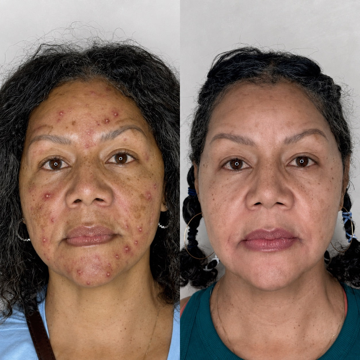 Experiencia de Rocío, 48 años – Trujillo
